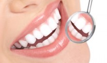 6 tipp a kevesebb fogkőért